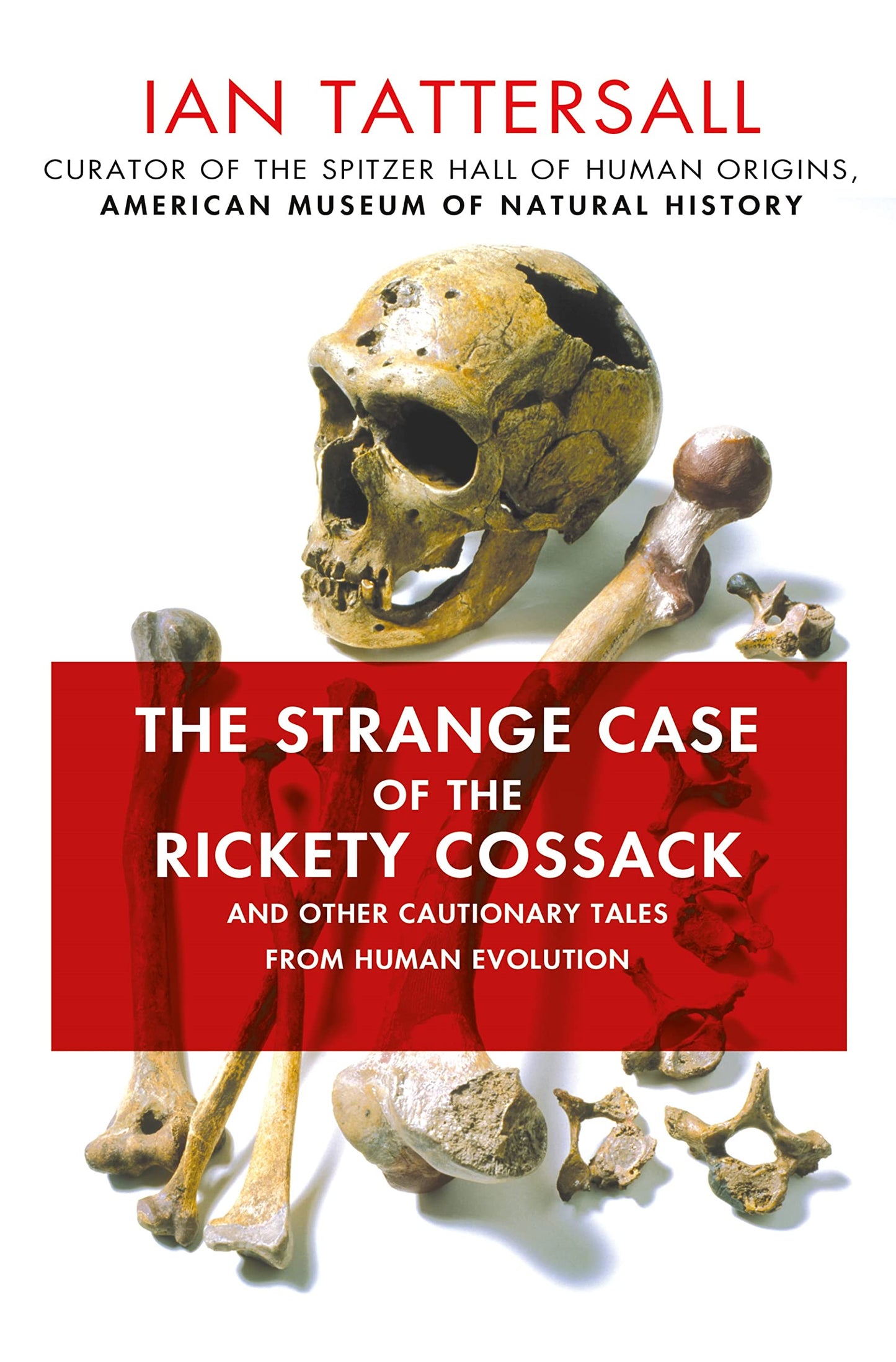 Strange Case of the Rickety Cossack: And Other Cautionary Tales from Human Evolution book cover
