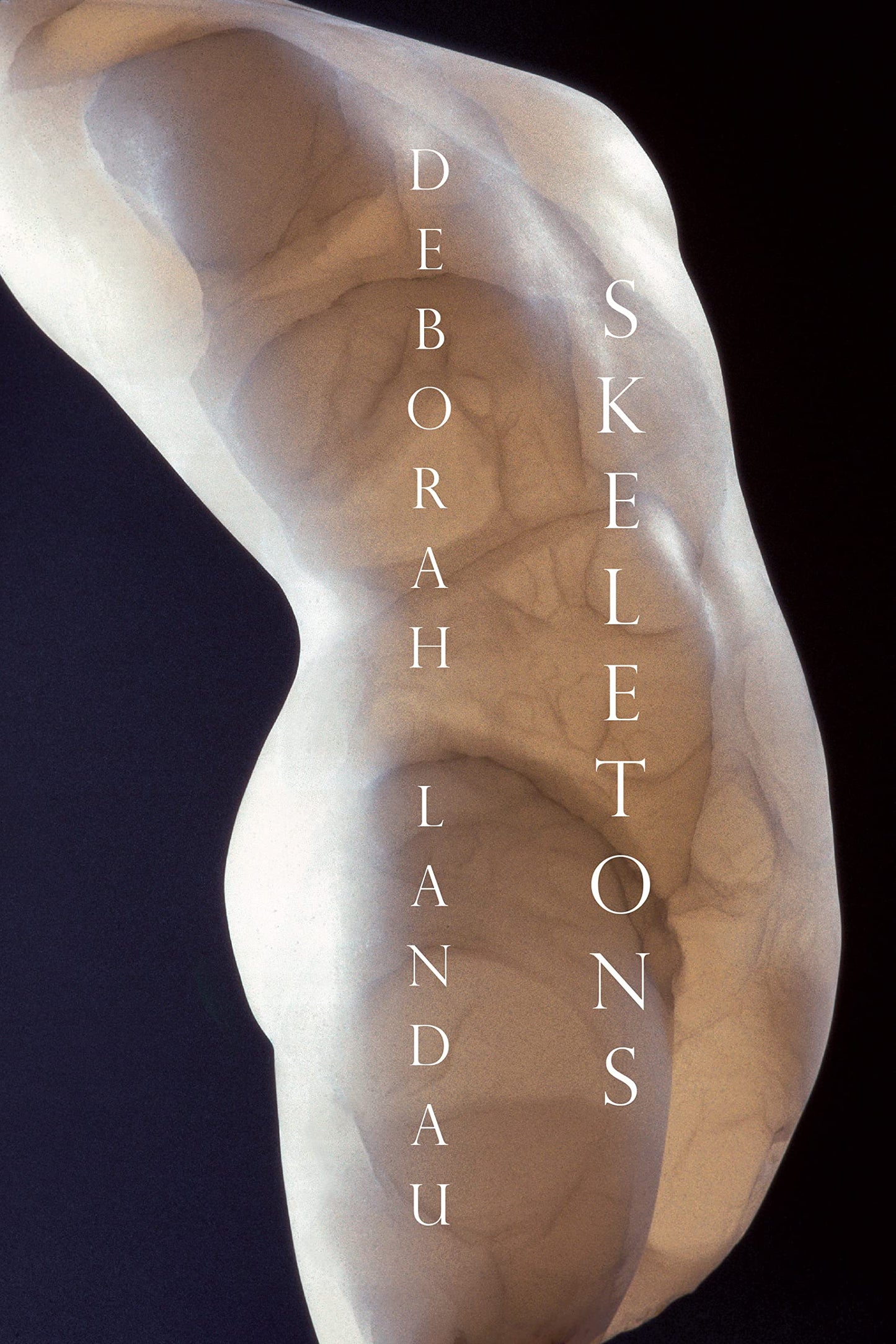 Skeletons book cover