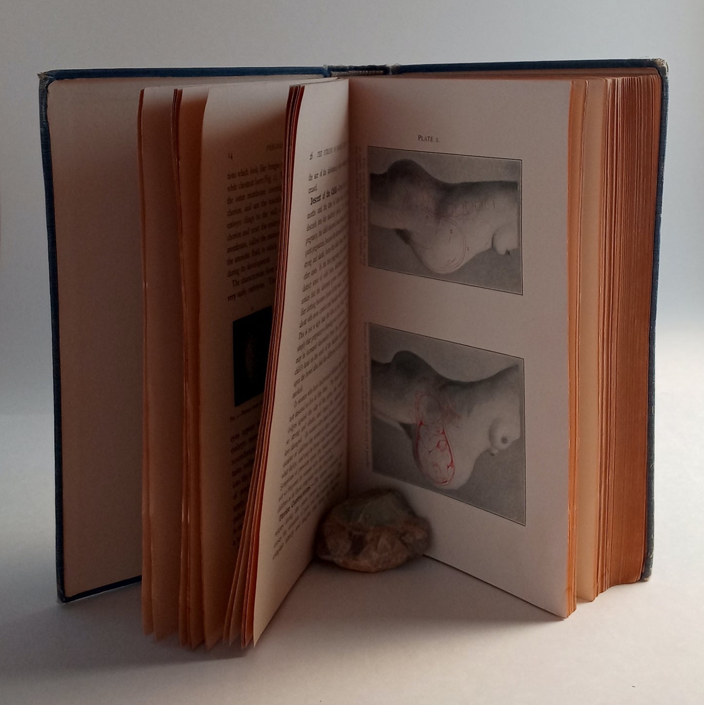 Obstetric and Gynecologic Nursing book cover