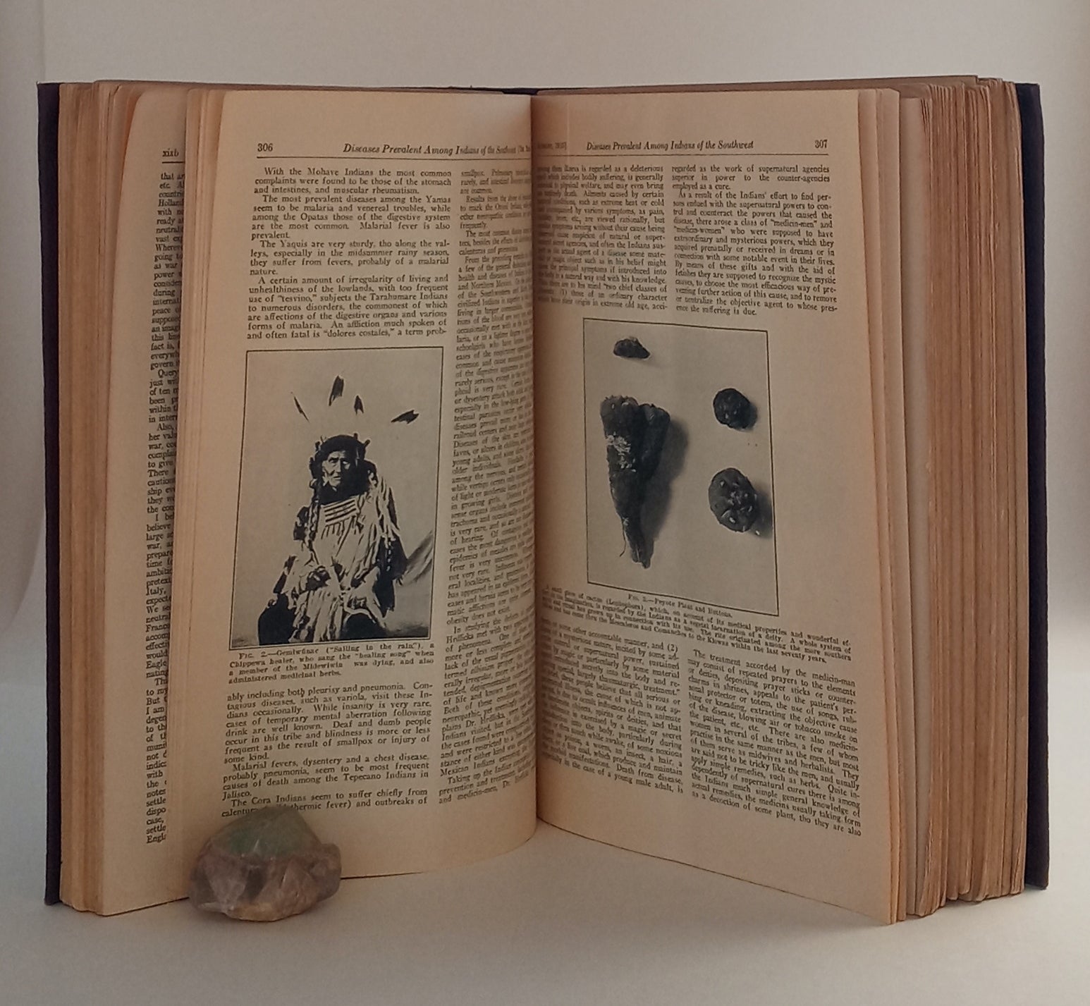 The Medical World, volumes XXXIII and XXXIV, 1915-1916 book cover