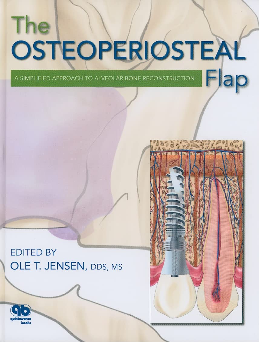 Osteoperiosteal Flap: A Simplified Approach to Alveolar Bone Reconstruction book cover