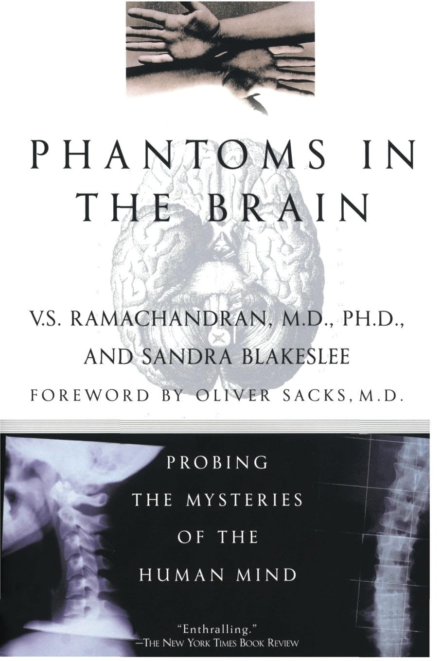 Phantoms in the Brain book cover