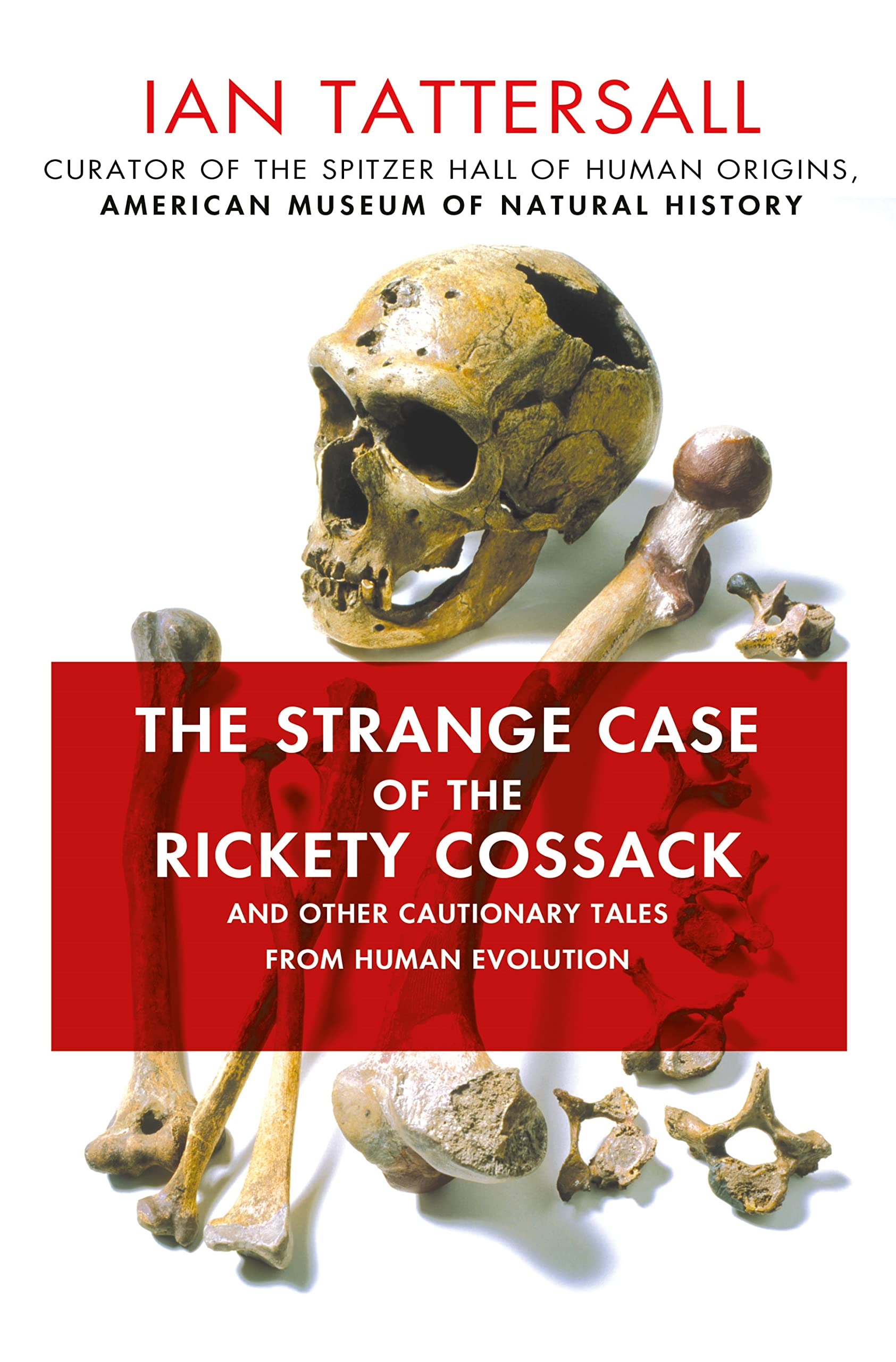 Strange Case of the Rickety Cossack: And Other Cautionary Tales from Human Evolution book cover