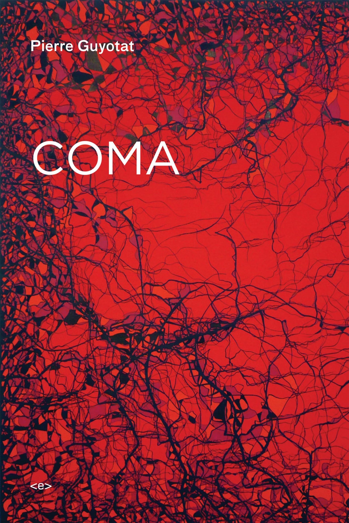 Coma