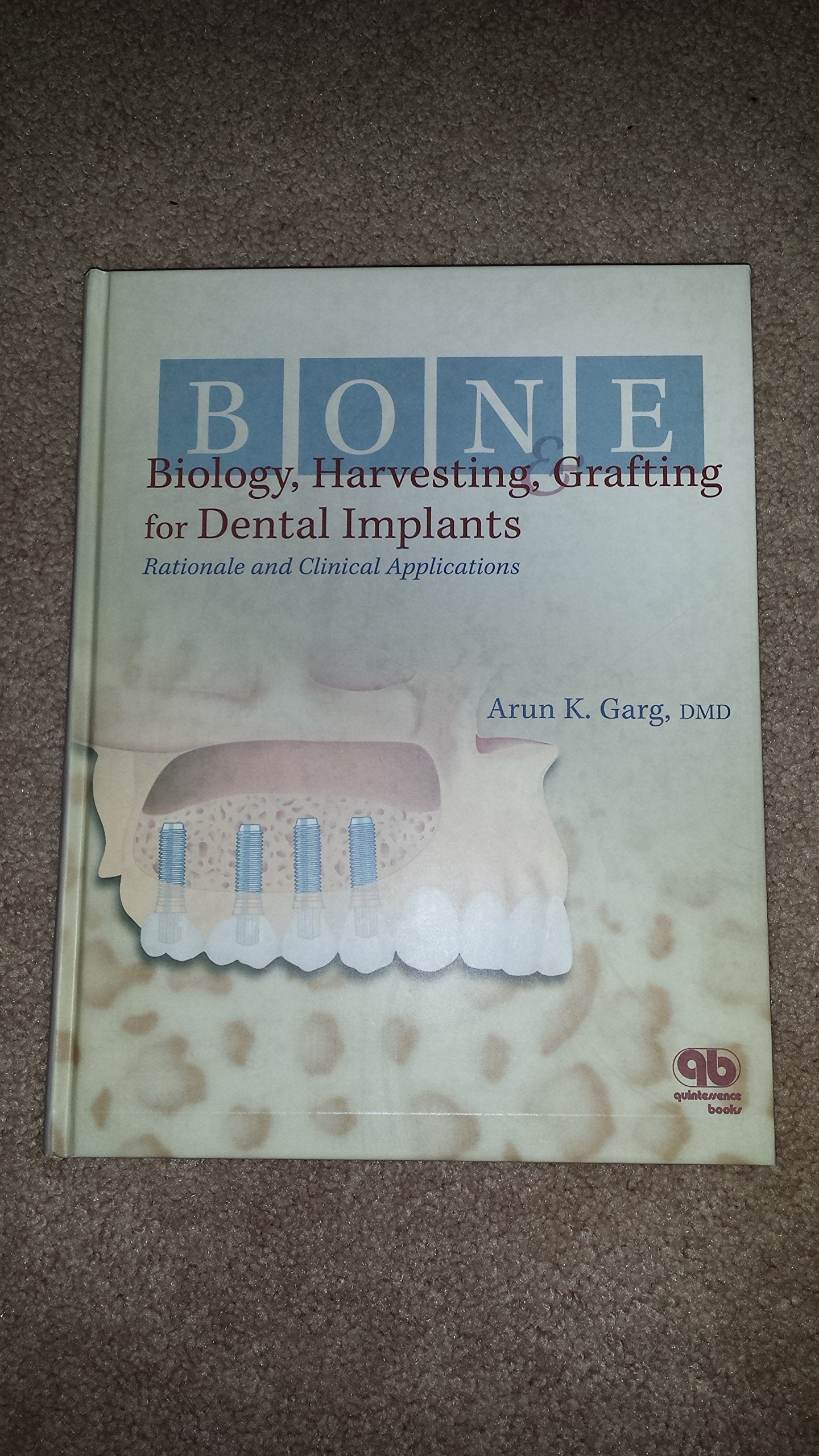 Bone Biology, Harvesting, Grafting for Dental Implants: Rationale and Clinical Applications book cover